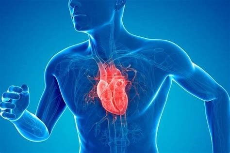 enfermedad cardiovascular - enfermedad cerebrovascular